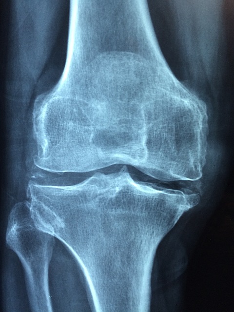 knee gd4de45b09 640