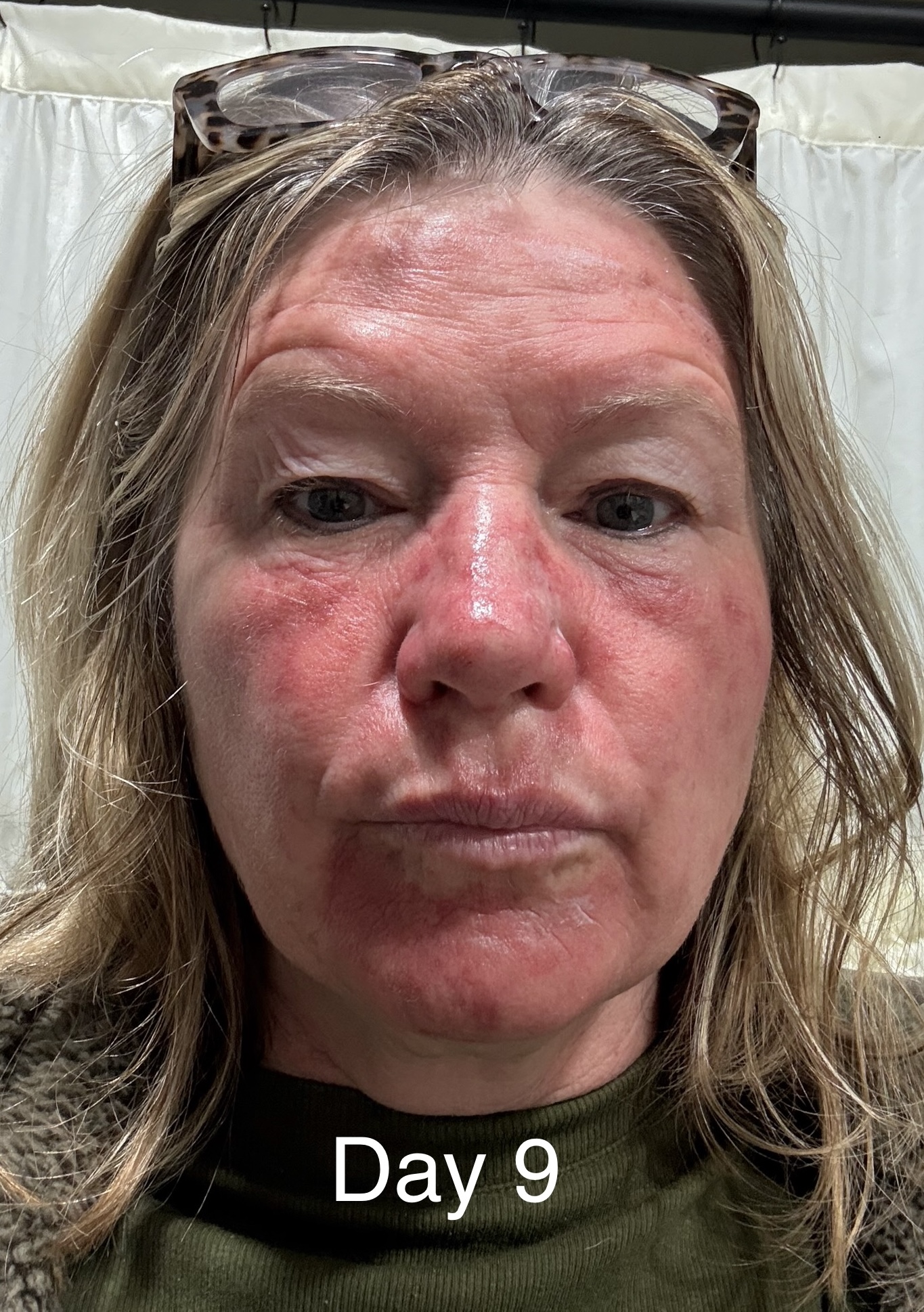 The Illusion of Safety: Why Familiar Drugs Deserve Scrutiny 